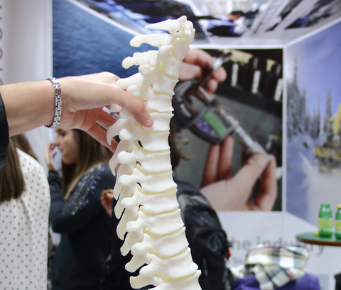 Unidos para fabricar columnas vertebrales en 3D