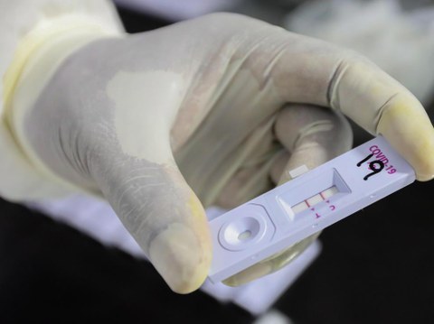 Antigenoen testa eta Covid-19aren autodiagnostikoa